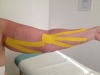 Lymfotaping_1